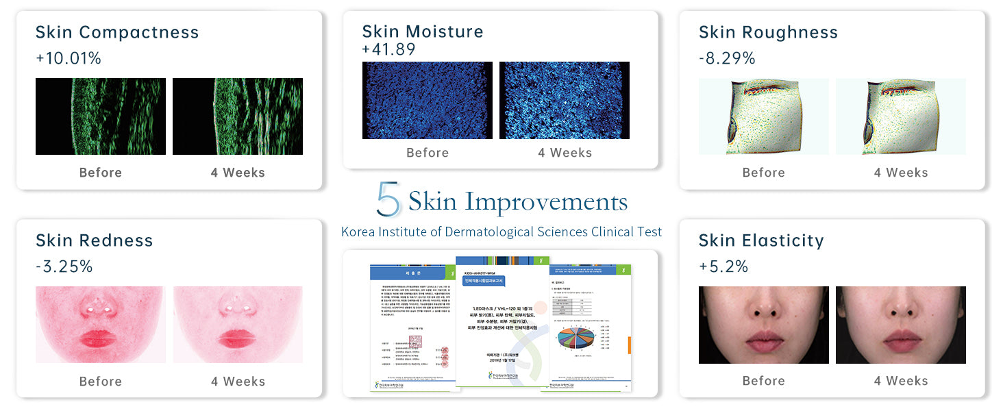 GYH Cloud-S LED Mask clinical test results showing 5 Skin Improvements in compactness, moisture, roughness, redness, and elasticity over 4 weeks, validated by Korea Institute of Dermatological Sciences.